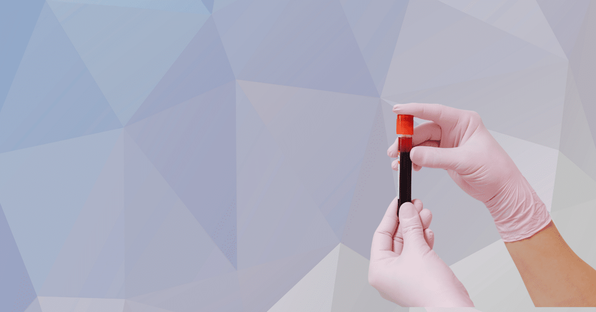 When Employers Can Require Drug or Alcohol Testing